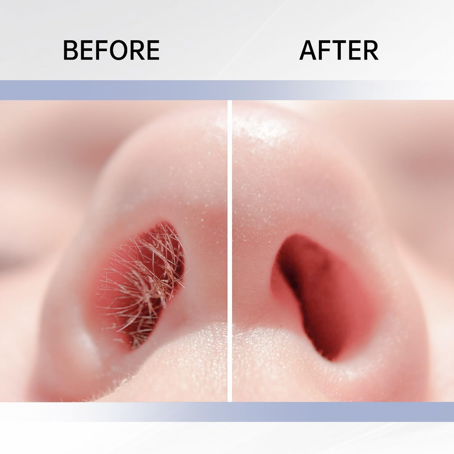 Nose Hair Trimmer